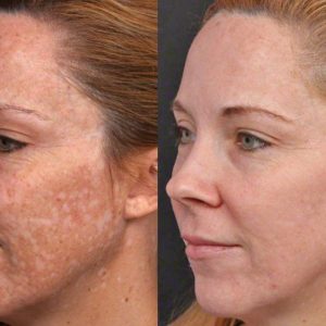 NOVACLEAR ATOPIS HYDRO CONTROL CREAM.pdf